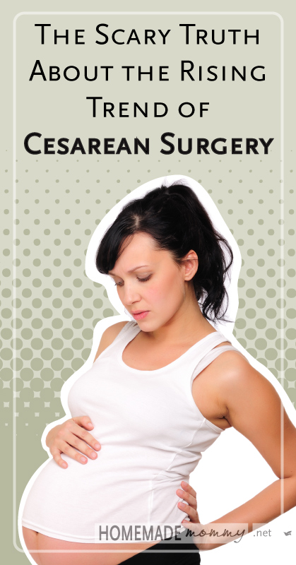 The Scary Truth About the Rising Trend of Cesarean Surgery | www.homemademommy.net